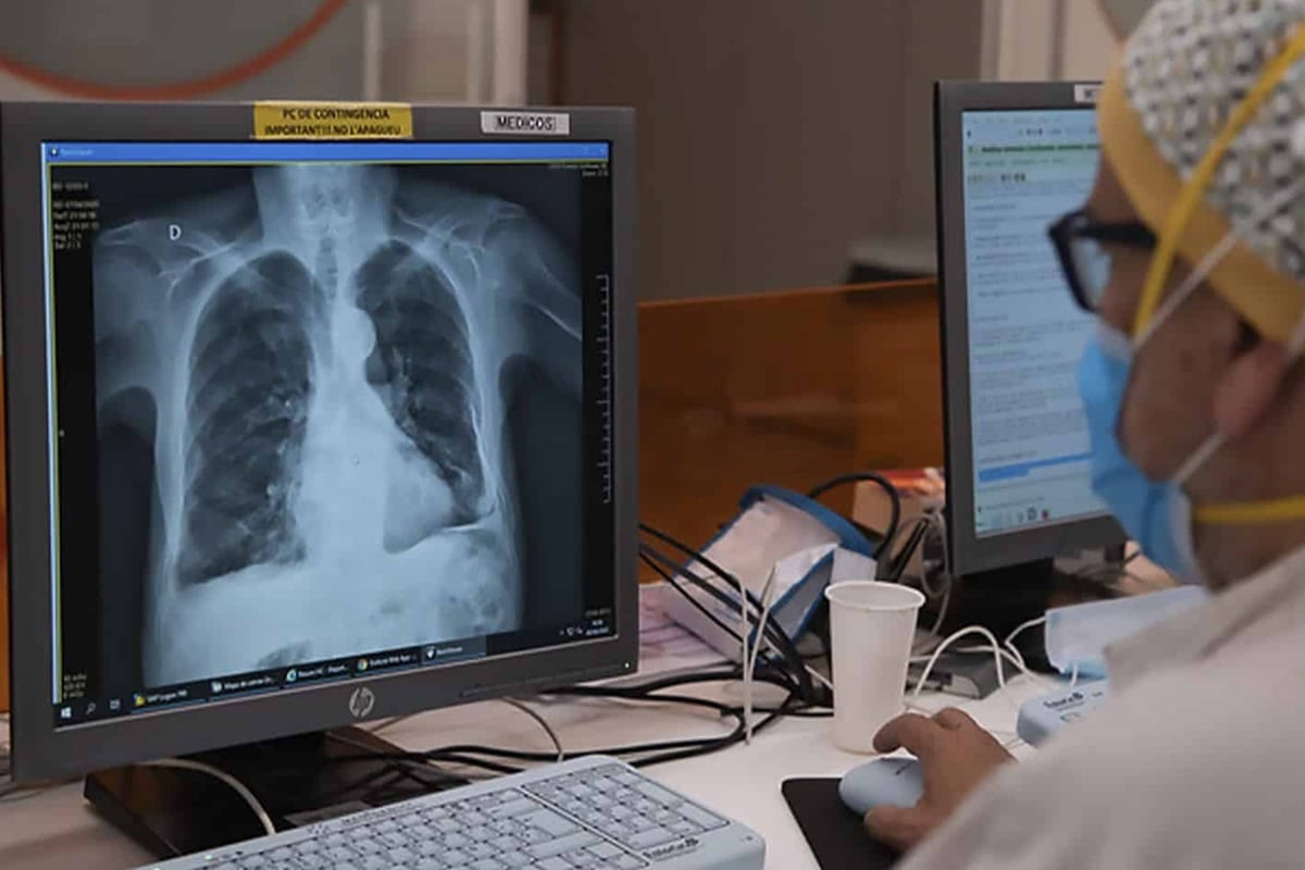 84 % de servicios de tomografía no funcionan: en clínicas cuestan hasta $500